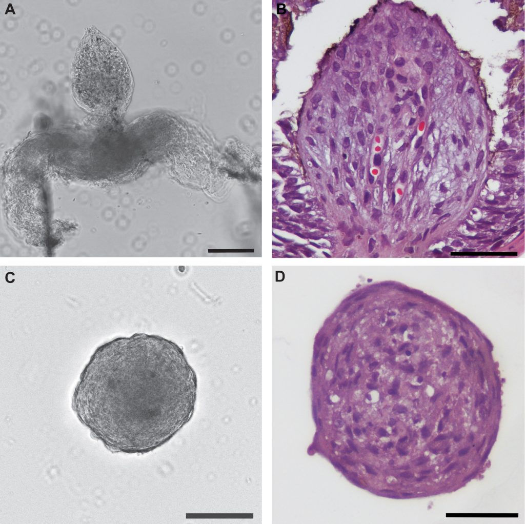 Figure 1. Freshly isolated human dermal papilla (DP) vs. DP spheroid.
A and B - Freshly isolated/native DP obtained by micro-dissection from a hair follicle (HF) unit; DP is a specialized mesenchymal progenitor cell population at the bottom of the HF that stimulates HF development and cyclic growth;
C and D - DP spheroids generated from ~2000 cultured human DP cells in vitro to mimic the native DP size; 
A and C are phase-contrast microscopy images; B and D are bright-field microscopy images upon H&E (hematoxylin-eosin) staining (hematoxylin stains cell nuclei a purplish blue, and eosin stains the extracellular matrix and cytoplasm pink).